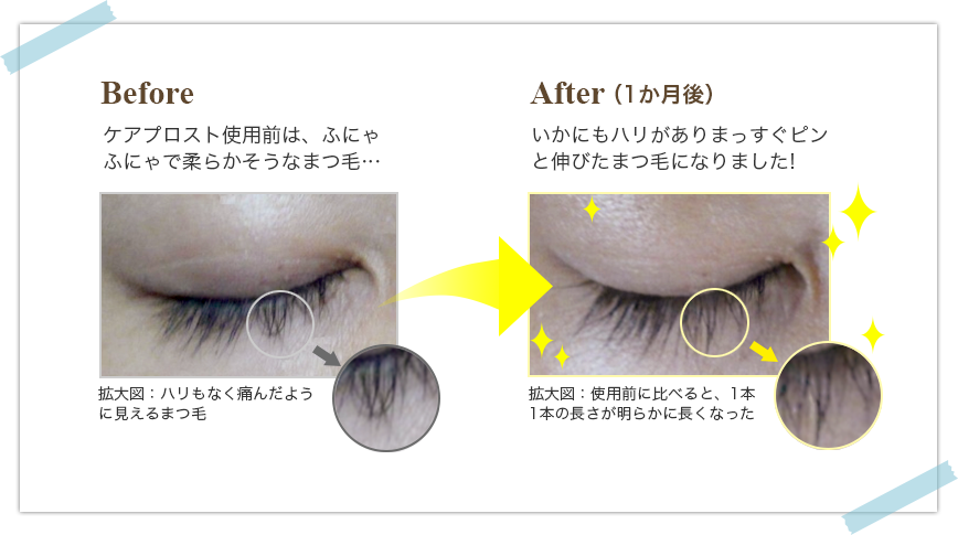 使用前と使用後比較写真